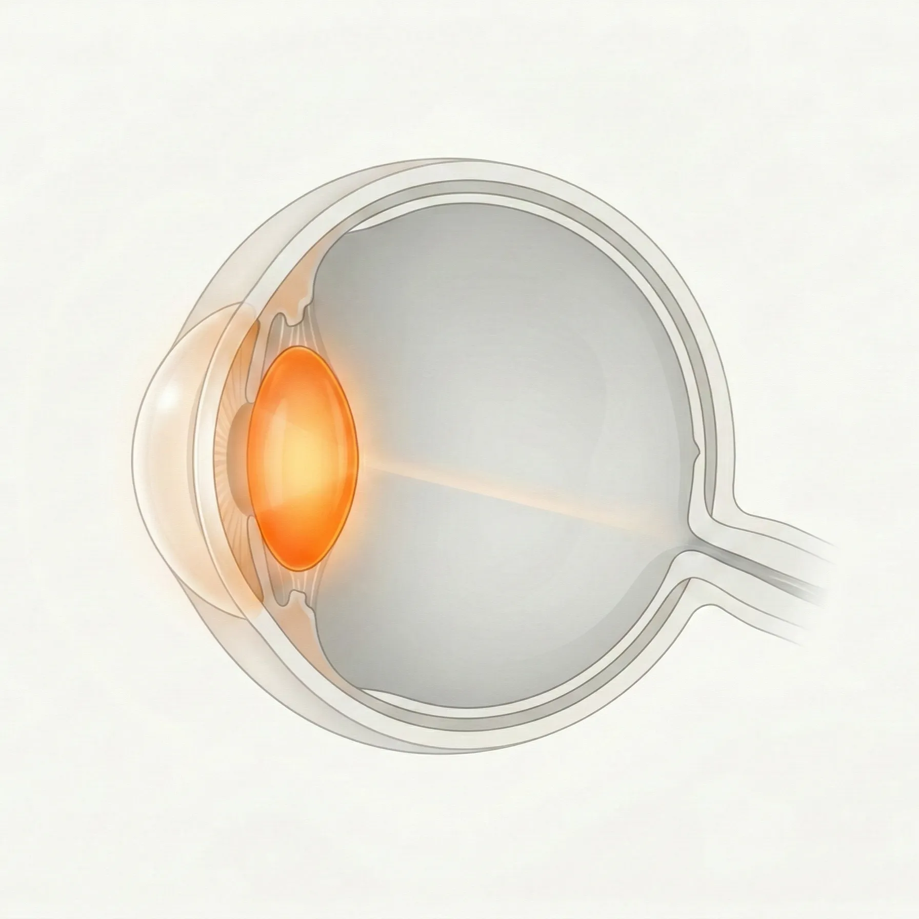 白内障・前眼部の参考画像