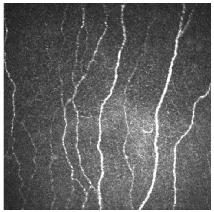 正常角膜のsubbasal nerve plexus