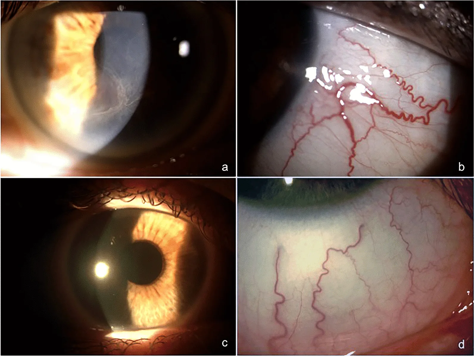 Cornea Verticillata image