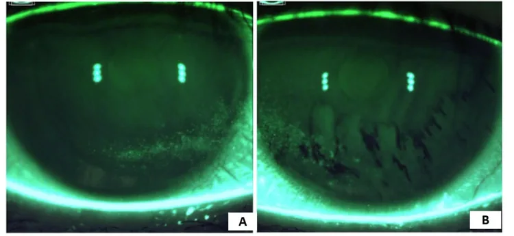 Perfluorohexyloctane image