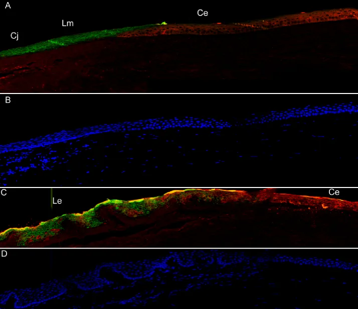 Pterygium image