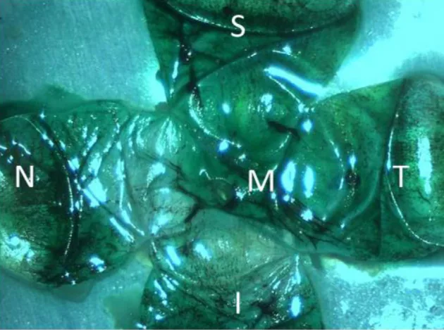 Suprachoroidal device の術中写真