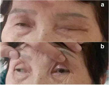 Bickerstaff???????????