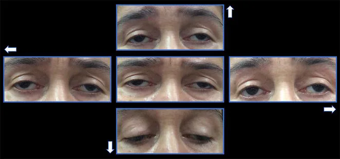 ??????????????????????