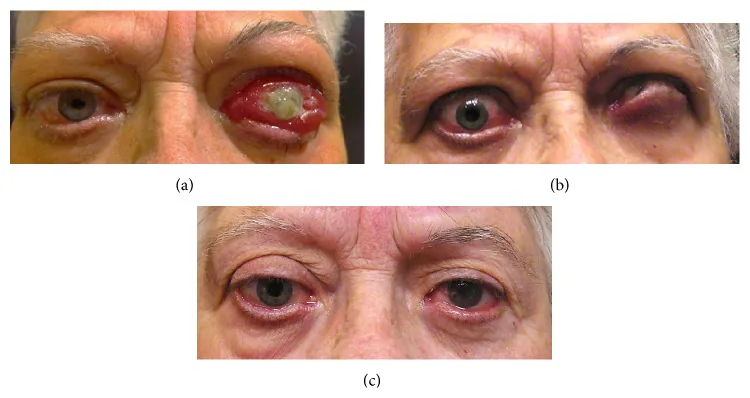 ????????????????????