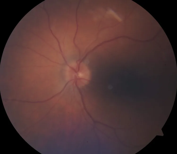 ????????????????????