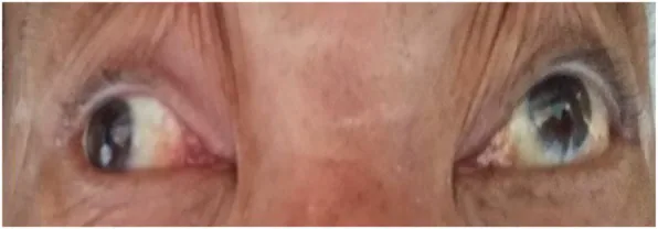 ???????????????????????