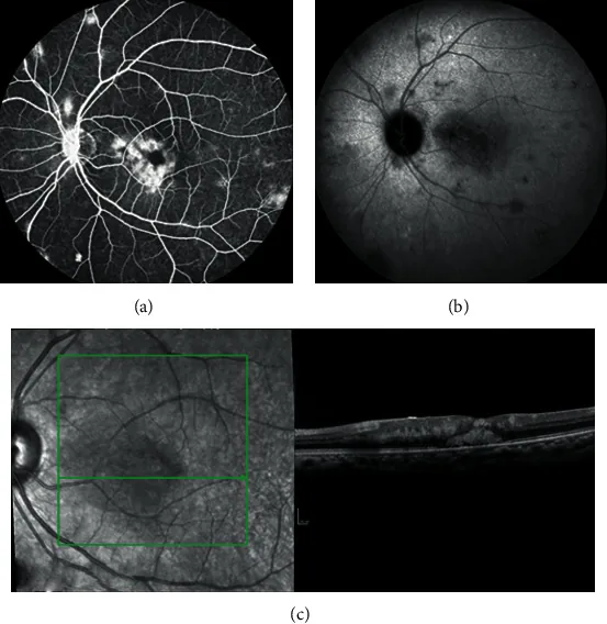 ?????????????????OCT??