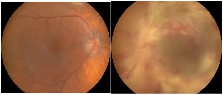 LADA????????????????