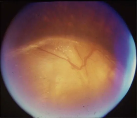 Noonan??????????????????