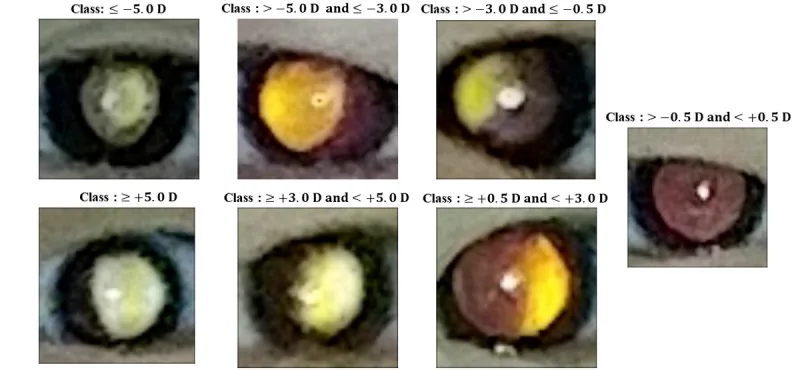 フォトスクリーニング（フォトレフラクション）で撮影された7種類の屈折異常クラスの瞳孔反射画像。三日月状の明るい反射が屈折値を示す。