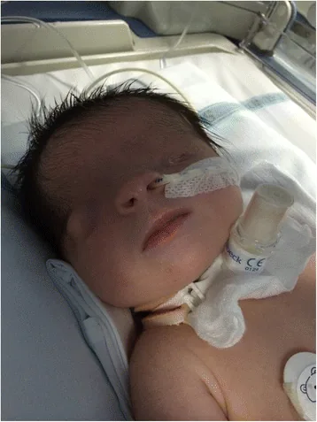 クリプトフタルモスの顔貌写真