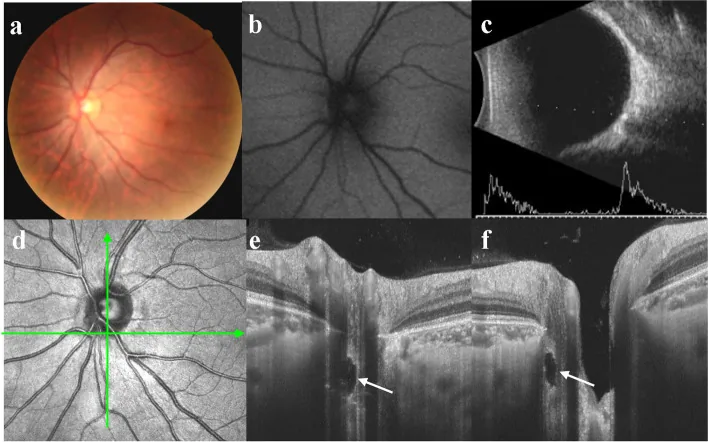 Color Fundus Photography Interpretation image