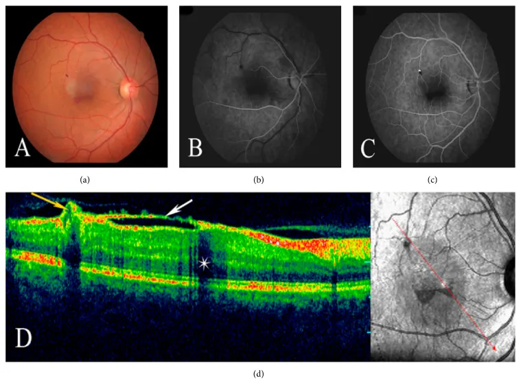 Familial Retinal Arterial Macroaneurysms  FRAM image